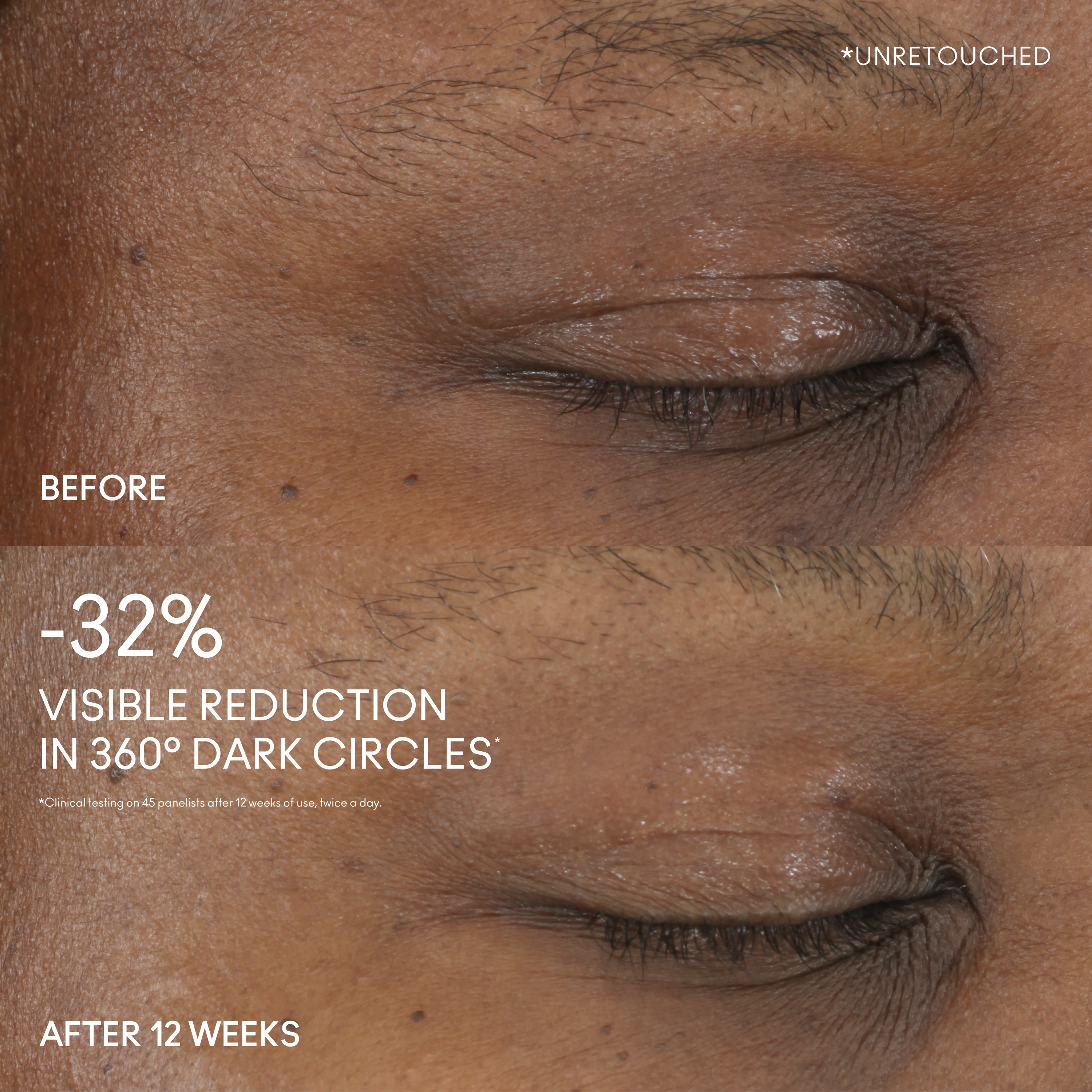 Hyper Real Serumizer Eye 360 Bright Eye Treatment for Everyday Wear and a refreshed looking eye area